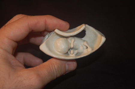 the-fetus-project-by-jorge-lopes-dos-santos-04.jpg