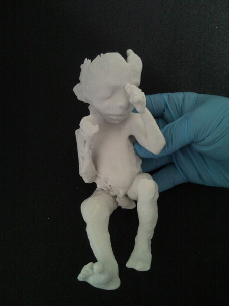 the-fetus-project-by-jorge-lopes-dos-santos-08.jpg