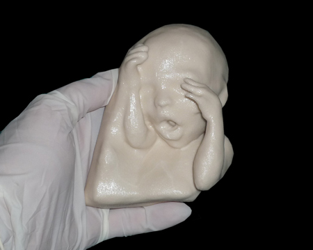 the-fetus-project-by-jorge-lopes-dos-santos-14.jpg