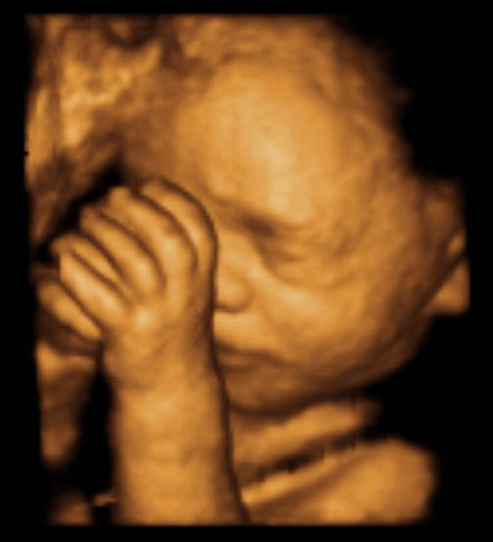 the-fetus-project-by-jorge-lopes-dos-santos-17.jpg