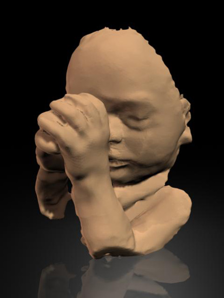 the-fetus-project-by-jorge-lopes-dos-santos-18.jpg
