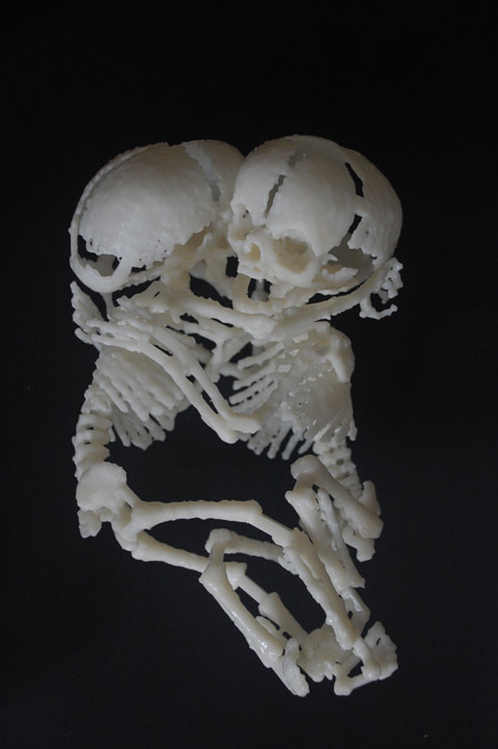 the-fetus-project-by-jorge-lopes-dos-santos-21.jpg