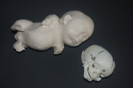 the-fetus-project-by-jorge-lopes-dos-santos-22.jpg