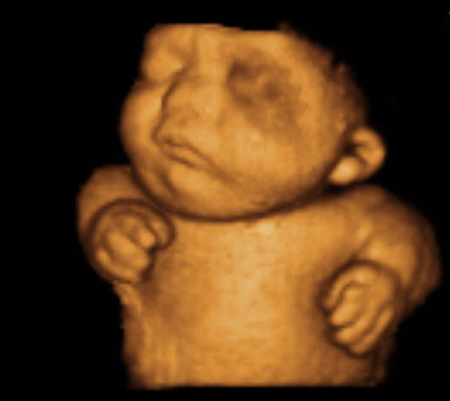 the-fetus-project-by-jorge-lopes-dos-santos-23.jpg