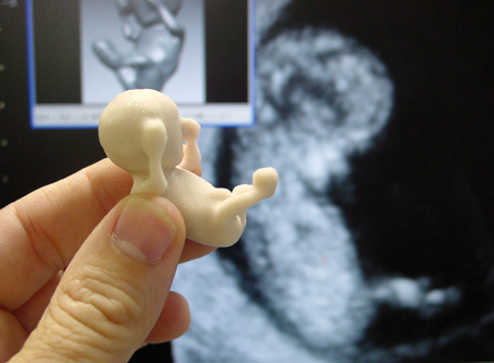 the-fetus-project-by-jorge-lopes-dos-santos-28.jpg
