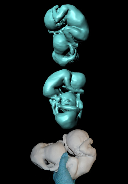 the-fetus-project-by-jorge-lopes-dos-santos-30.jpg