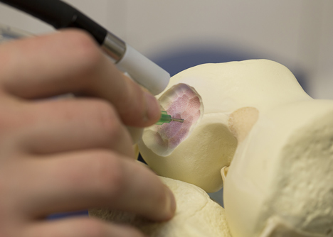BioPen draws living cells onto wounds to help them heal faster