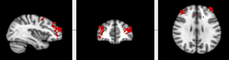 Brain Manufacturing by Merel Bekking