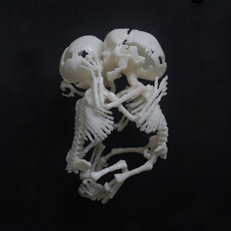 The Foetus Project by Jorge Lopes Dos Santos
