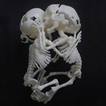 The Foetus rapid prototyping project