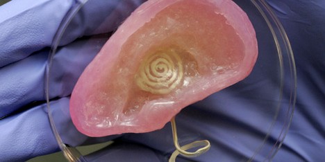 3D-printed bionic ear