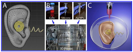 3D-printed bionic ear 3D-printed bionic ear
