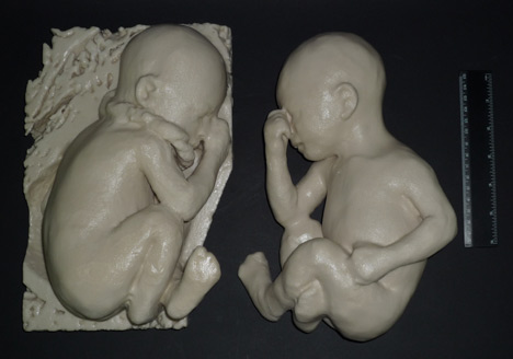 Print Shift 3D printing and health Print Shift 3D printing and health