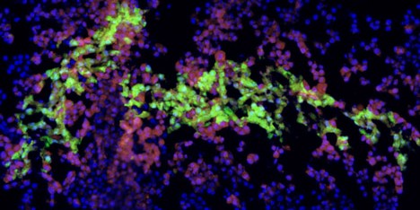 "Printed human tissues are ten years away"