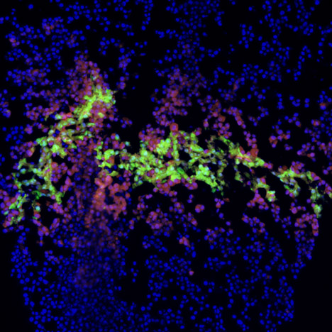 "Printed human tissues are ten years away"