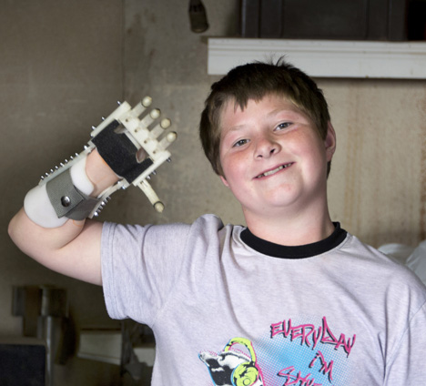 Robohand
