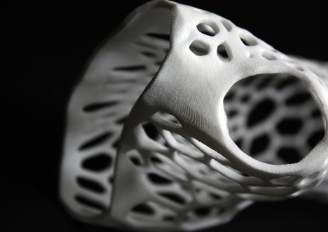Cortex 3D-printed cast for fractured bones by Jake Evill