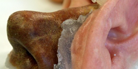 3D printed prostheses by Fripp Design and Research