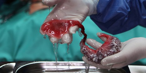 Circumventive Organs by Agatha Haines