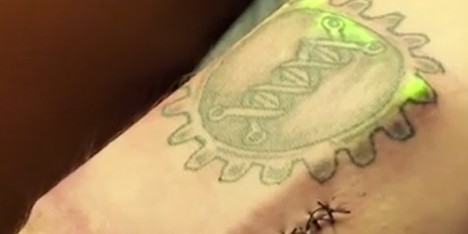 DIY Cyborg implants body tracking device under his skin