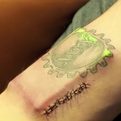 DIY Cyborg implants body tracking device under his skin
