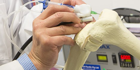 3D-printing BioPen “draws” with living cells to repair damaged bones