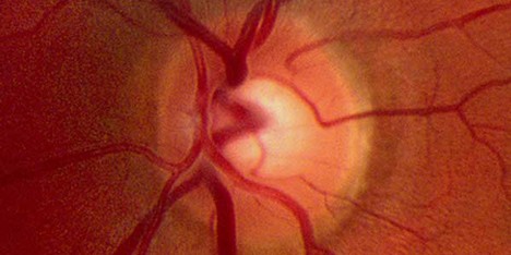 Microscopic image of a retina