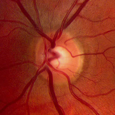 Microscopic image of a retina