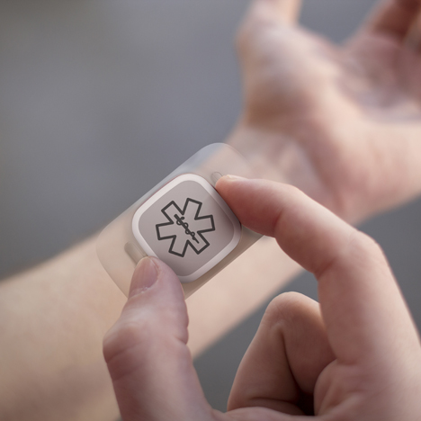 Epilepsy aid uses wearable sensors to predict seizures and call for help