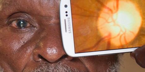 Portable Eye Examination Kit (Peek)