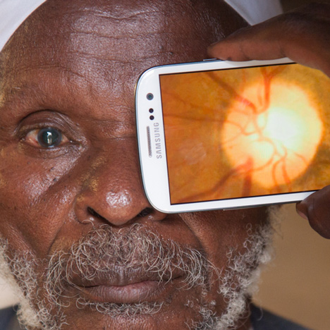 Portable Eye Examination Kit (Peek)
