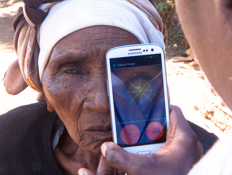 Portable Eye Examination Kit (Peek)
