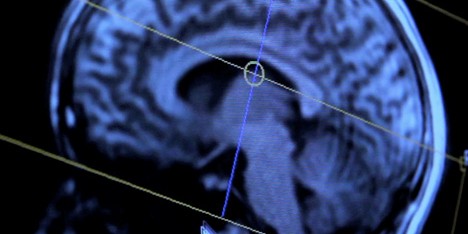 Brain Manufacturing by Merel Bekking