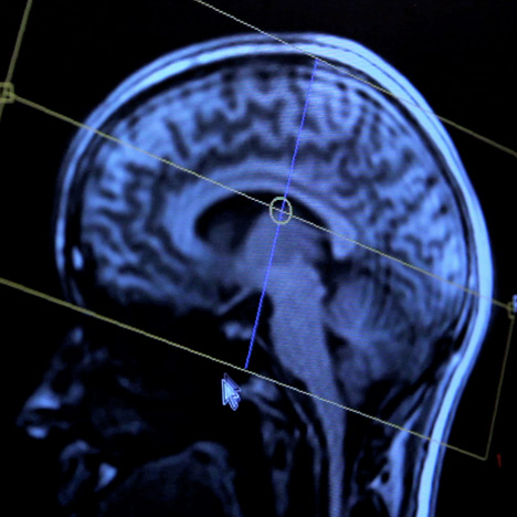Brain Manufacturing by Merel Bekking