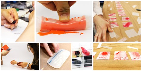 Bruise for sporting injuries by RCA students