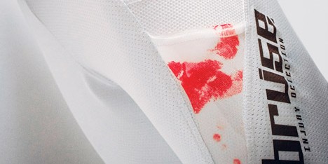 Bruise for sporting injuries by RCA students