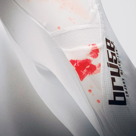Bruise for sporting injuries by RCA students