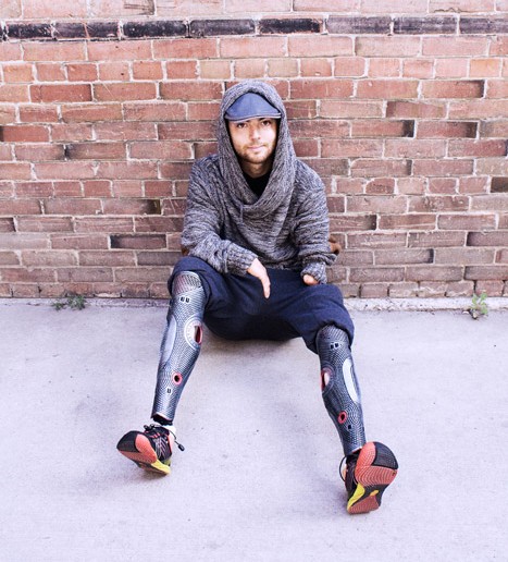 Prosthetic Covers by Alleles Design Studio