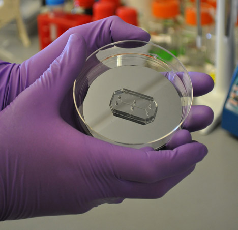 Organs-on-Chips by the Wyss Institute for Biologically Inspired Engineering
