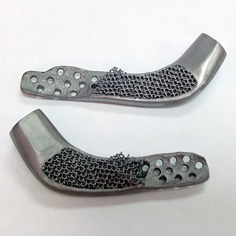 Custom-fit 3D-printed medical implant for bone reconstruction by Sebastiaan Deviaene