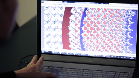 Custom-fit 3D-printed medical implant for bone reconstruction by Sebastiaan Deviaene