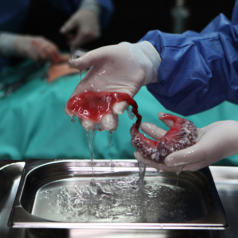 Circumventive-Organs-by-Agatha-Haines_dezeen_sq
