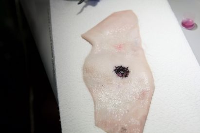 Dermal Abyss by MIT Researchers