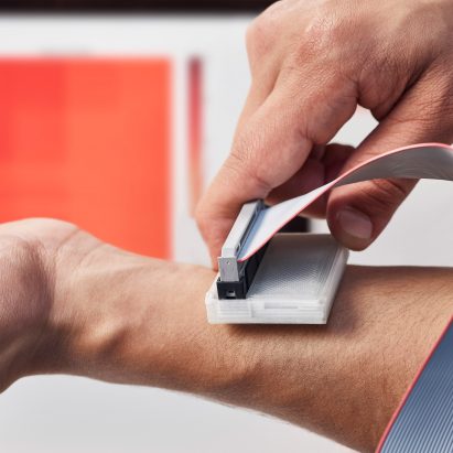 Device that detects skin cancer wins James Dyson Award 2017
