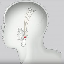 Dezeen Weekly features Elon Musk’s startup and its invention to connect human brains to computers