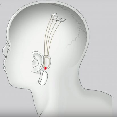 Dezeen Weekly features Elon Musk’s startup and its invention to connect human brains to computers