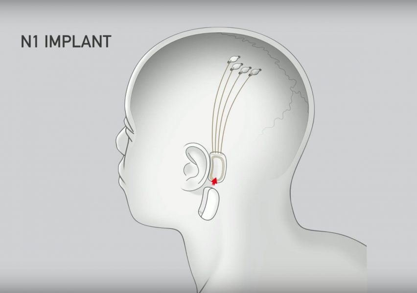 Dezeen Weekly features Elon Musk’s startup and its invention to connect human brains to computers