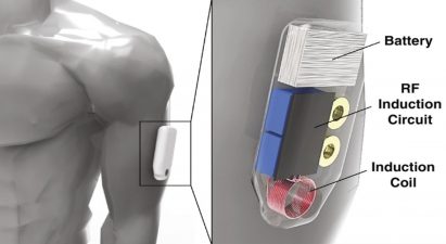 Wearable Opioid Antidote Device by Purdue University researchers