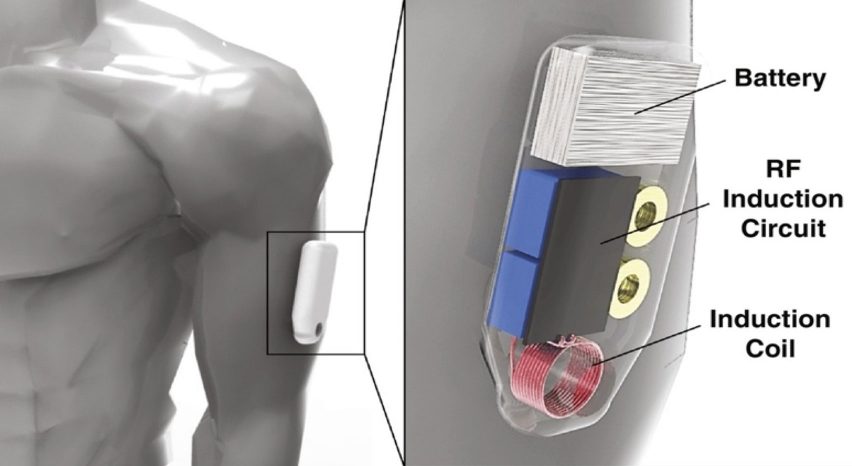 Wearable Opioid Antidote Device by Purdue University researchers