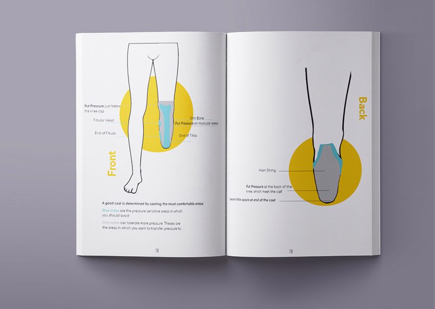 Student's DIY design project empowers people to make their own prostheses